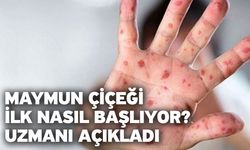 Maymun çiçeği ilk nasıl başlıyor? Uzmanı açıkladı