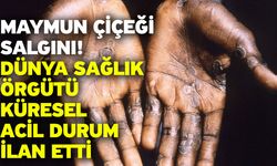 Maymun çiçeği salgını! Dünya sağlık örgütü küresel acil durum ilan etti