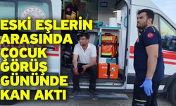 Eski eşlerin arasında çocuk görüş gününde kan aktı