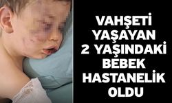 Vahşeti yaşayan 2 yaşındaki bebek hastanelik oldu