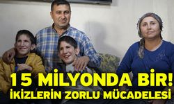 15 Milyonda Bir! İkizlerin Zorlu Mücadelesi