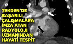 Tekden’de başarılı çalışmalara imza atan radyoloji uzmanından hayati tespit
