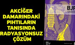 Akciğer Damarındaki Pıhtıların Tanısında Radyasyonsuz Çözüm