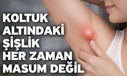Koltuk Altındaki Şişlik Her Zaman Masum Değil