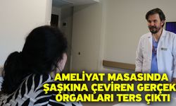 Ameliyat Masasında Şaşkına Çeviren Gerçek! Organları Ters Çıktı