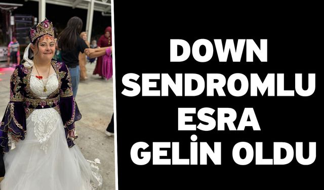 Down sendromlu Esra gelin oldu