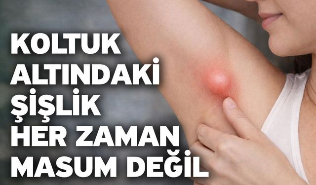 Koltuk Altındaki Şişlik Her Zaman Masum Değil