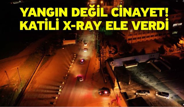 Yangın Değil Cinayet! Katili X-Ray Ele Verdi