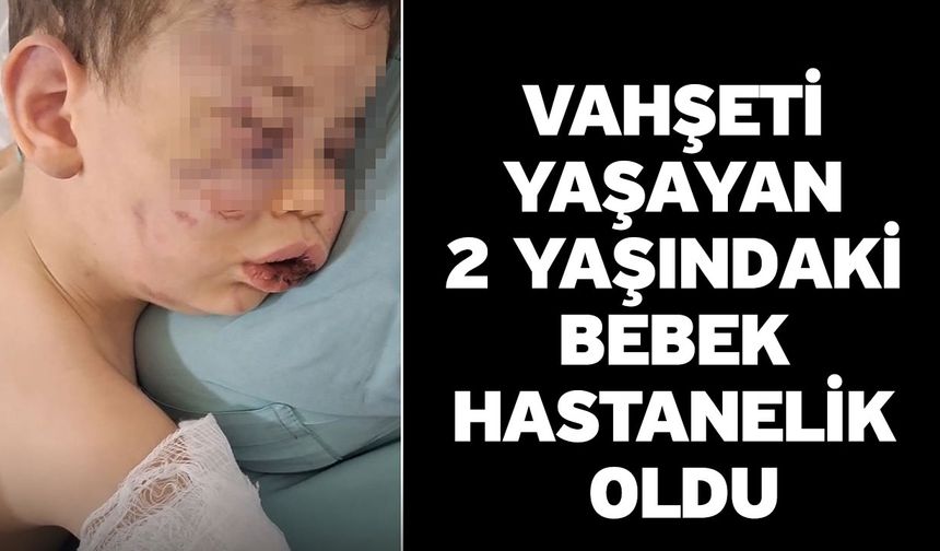 Vahşeti yaşayan 2 yaşındaki bebek hastanelik oldu