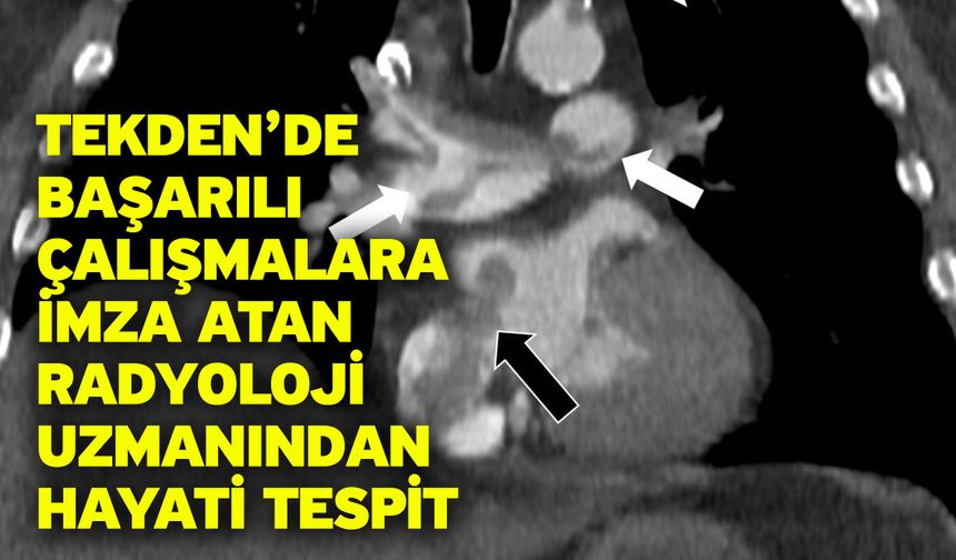 Tekden’de başarılı çalışmalara imza atan radyoloji uzmanından hayati tespit