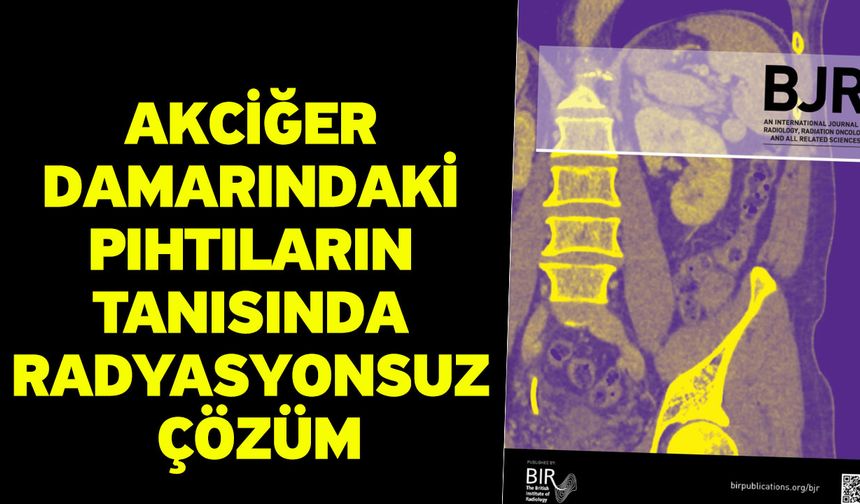 Akciğer Damarındaki Pıhtıların Tanısında Radyasyonsuz Çözüm