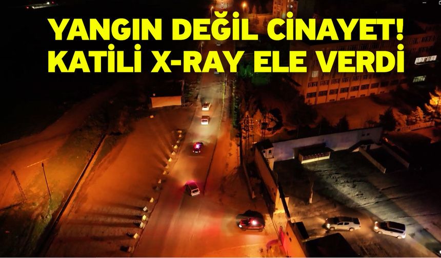 Yangın Değil Cinayet! Katili X-Ray Ele Verdi